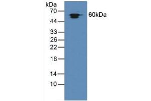 Detection of Hsp60 in Rat Liver Tissue using Polyclonal Antibody to Heat Shock Protein 60 (Hsp60) (HSPD1 antibody  (AA 172-343))