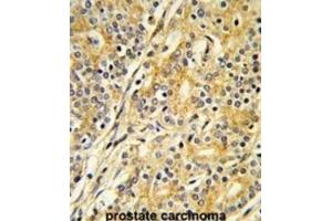 Immunohistochemistry (IHC) image for anti-Cytochrome P450, Family 51, Subfamily A, Polypeptide 1 (CYP51A1) antibody (ABIN3003943)