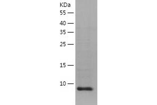 VAMP2 Protein (AA 1-94) (His tag)