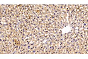 Immunohistochemistry (IHC) image for anti-Fibrinogen beta Chain (FGB) (AA 29-491) antibody (ABIN7438043)