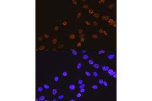 Immunofluorescence analysis of C6 cells using HD antibody (ABIN7267708).