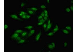 Immunofluorescence (IF) image for anti-Hypoxia Inducible Factor 1, alpha Subunit (Basic Helix-Loop-Helix Transcription Factor) (HIF1A) (AA 579-826) antibody (ABIN7156029)