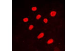 Immunofluorescent analysis of CTBP2 staining in A549 cells. (CTBP2 antibody  (C-Term))