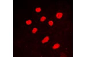 Immunofluorescent analysis of CTBP2 staining in A549 cells.