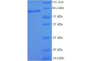 SDS-PAGE (SDS) image for NCK Adaptor Protein 2 (NCK2) (AA 1-380), (full length) protein (His-SUMO Tag) (ABIN5709993)