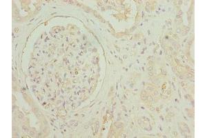 Immunohistochemistry of paraffin-embedded human kidney tissue using ABIN7154541 at diluton of 1:100 (GDF15 antibody  (AA 198-308))