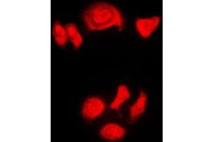 Immunofluorescent analysis of Nucleophosmin (pT199) staining in HeLa cells. (NPM1 antibody  (pSer199))
