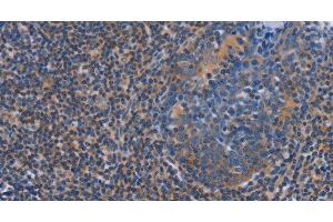 Immunohistochemistry of paraffin-embedded Human tonsil using AGFG1 Polyclonal Antibody at dilution of 1:60