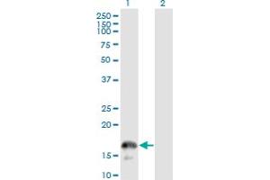 Western Blotting (WB) image for anti-CD247 Molecule (CD247) (AA 1-164) antibody (ABIN560227)