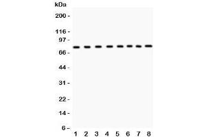 Western blot testing of MCM7 antibody and Lane 1:  rat brain;  2: human placenta;  3: mouse NIH3T3;  4: (h) HeLa;  5: (h) Jurkat;  6: (h) 22RV1;  7: (h) COLO320;  8: (r) PC12 lysate.