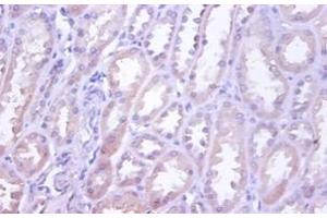 Immunohistochemistry of paraffin-embedded human kidney using TNFRSF10D / TRAIL-R4 / DCR2 antibody at dilution of 1:100. (DcR2 antibody  (FITC))