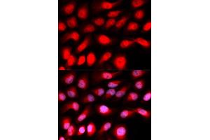 Immunofluorescence analysis of U20S cell using ZEB1 antibody. (ZEB1 antibody)