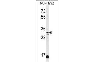 Western blot analysis of DDO Antibody (Center) (ABIN650991 and ABIN2840026) in NCI- cell line lysates (35 μg/lane).