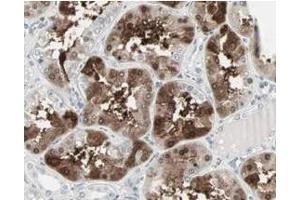 Immunohistochemistry (IHC) image for anti-Cbl proto-oncogene C (CBLC) (C-Term) antibody (ABIN129659)
