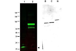 Image no. 1 for anti-SPANX Family, Member C (SPANXC) antibody (ABIN401033)