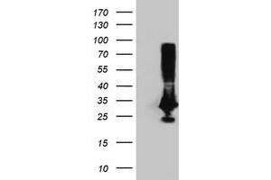 Image no. 2 for anti-Phenylethanolamine N-Methyltransferase (PNMT) antibody (ABIN1500313) (PNMT antibody)