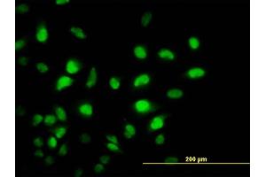 Immunofluorescence of monoclonal antibody to PCAF on HeLa cell. (KAT2B antibody  (AA 353-452))