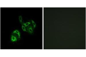 Immunofluorescence analysis of A549 cells, using SLC27A4 Antibody.
