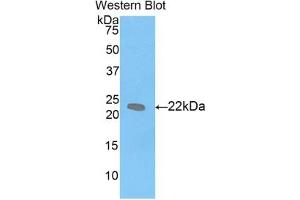 Detection of Recombinant LIF, Mouse using Polyclonal Antibody to Leukemia Inhibitory Factor (LIF) (LIF antibody  (AA 25-203))