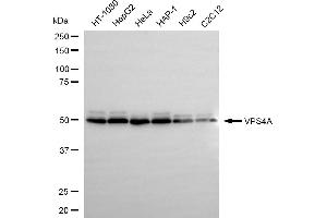 anti-Vacuolar Protein Sorting-Associated Protein 4A (VPS4A) antibody