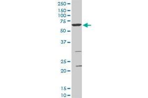 SMARCD3 monoclonal antibody (M02), clone 5F12. (SMARCD3 antibody  (AA 385-483))