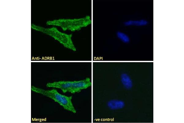 ADRB1 antibody  (Internal Region)