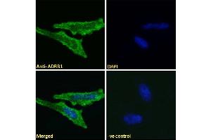 ABIN185584 Immunofluorescence analysis of paraformaldehyde fixed HeLa cells, permeabilized with 0.