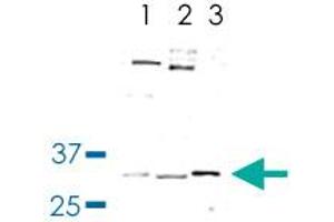 Western Blot analysis of (1) nuclear extract of HeLa cells, (2) Drosophila adult whole cell extracts, and (3) purified human PAF complex. (WDR61 antibody)