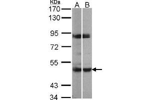WB Image Sample(30 μg of whole cell lysate) A:293T B:H1299 7. (MAPKAP Kinase 5 antibody)
