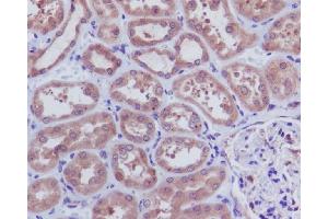 Immunohistochemical analysis of paraffin-embedded human kidney, using Caspase-3 p12 Antibody. (Recombinant Caspase 3 p12 antibody)