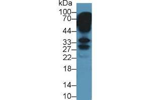 Western Blotting (WB) image for anti-Keratocan (KERA) (AA 21-292) antibody (ABIN7443983)