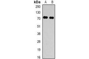 Western blot analysis of TBRG4 expression in Hela (A), HepG2 (B) whole cell lysates. (TBRG4 antibody)
