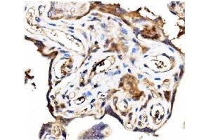 IHC analysis of Stathmin 1 using anti-Stathmin 1 antibody (ABIN3043301). (Stathmin 1 antibody  (N-Term))