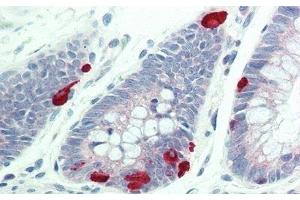 Detection of FUR in Human Colon Tissue using Polyclonal Antibody to Furin (FUR) (FURIN antibody  (AA 587-748))