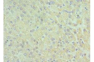 Immunohistochemistry of paraffin-embedded human liver tissue using ABIN7153959 at dilution of 1:100 (GLUD2 antibody  (AA 319-558))