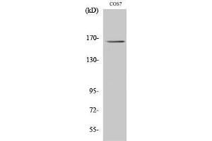 Western Blotting (WB) image for anti-Myomesin 2 (MYOM2) (Internal Region) antibody (ABIN3176183) (MYOM2 antibody  (Internal Region))