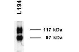 UT A1 Immunoblot (Rat inner medulla). (Solute Carrier Family 14 (Urea Transporter, Kidney) Member 2 (SLC14A2) (AA 911-929) antibody)