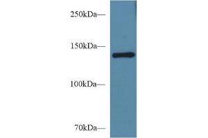 Western Blot; Sample: Mouse Serum; Primary Ab: 1µg/ml Rabbit Anti-Mouse SEMA4D Antibody Second Ab: 0. (SEMA4D/CD100 antibody  (AA 502-636))