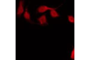 ABIN6267590 staining HeLa by IF/ICC. (MEF2A antibody  (pThr312))