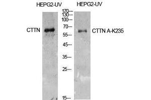 Western Blot (WB) analysis of HepG2-UV cells using Acetyl-Cortactin (K235) Polyclonal Antibody. (Cortactin antibody  (acLys235))