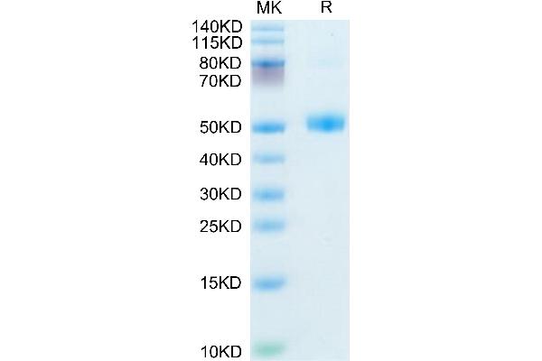 FSHB Protein (AA 20-130) (Fc Tag)