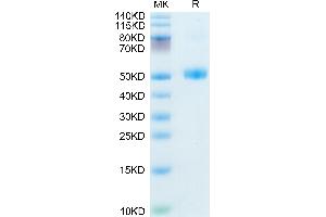 Mouse FSHB on Tris-Bis PAGE under reduced condition. (FSHB Protein (AA 20-130) (Fc Tag))