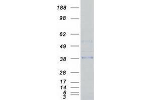 Western Blotting (WB) image for Msh Homeobox 1 (MSX1) protein (Myc-DYKDDDDK Tag) (ABIN2726478)