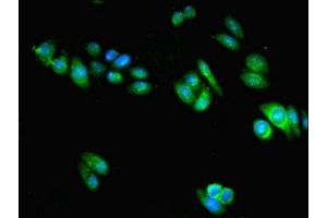 Immunofluorescent analysis of HepG2 cells using ABIN7169655 at dilution of 1:100 and Alexa Fluor 488-congugated AffiniPure Goat Anti-Rabbit IgG(H+L) (SRP54 antibody  (AA 1-504))