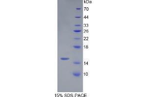 SDS-PAGE analysis of Mouse Serglycin Protein. (SRGN Protein)