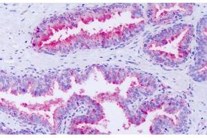 Anti-GPR63 antibody IHC staining of human prostate. (GPR63 antibody  (Cytoplasmic Domain))