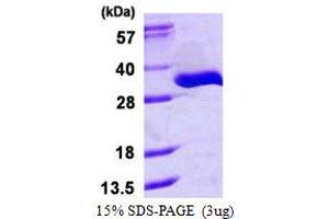 tRNA Phosphotransferase 1 (TRPT1) (AA 1-253) protein (His tag)