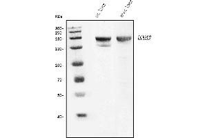 Western blot analysis of Duox2 using anti-Duox2 antibody (ABIN7602208).