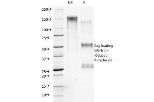 SDS-PAGE Analysis Purified Collagen VII Mouse Monoclonal Antibody (LH7.