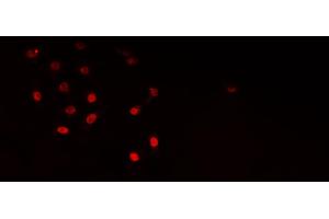Immunofluorescence (fixed cells) (IF/ICC) image for anti-ELAV (Embryonic Lethal, Abnormal Vision, Drosophila)-Like 1 (Hu Antigen R) (ELAVL1) (Internal Region) antibody (ABIN6261510)